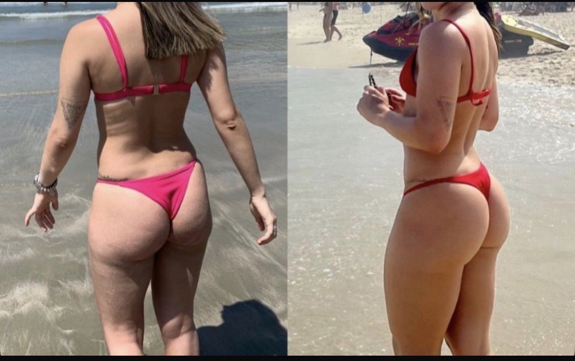 Antes e depois de aluna do método MCL