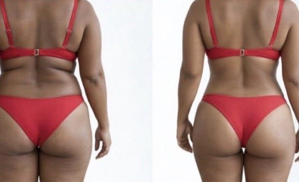 Antes e depois de aluna do método MCL
