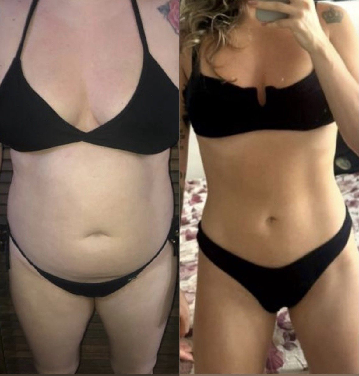 Antes e depois de aluna do método MCL